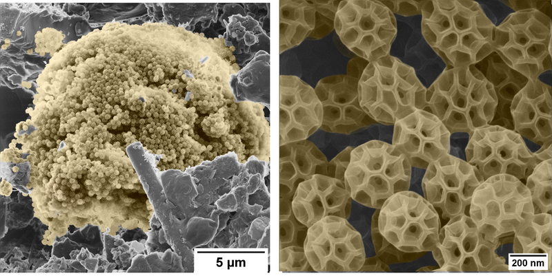 HIM dirty filter zoom